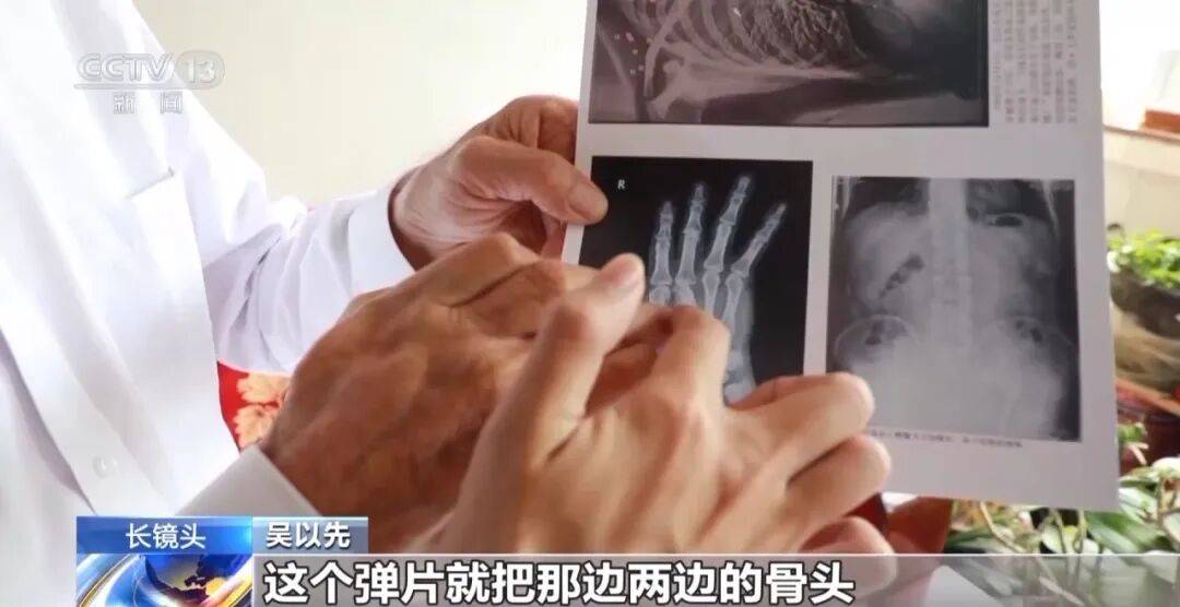 皇冠信用怎么弄_“老先生皇冠信用怎么弄，您把项链取下来再做CT”“你看是不是弹片”