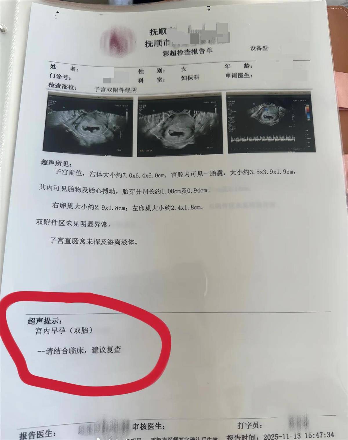 怎么开通皇冠信用开户_辽宁一孕妇两个月内从一胎变四胞胎怎么开通皇冠信用开户，每次产检发现多出一胎，医生：系同卵四胞胎，概率1300万至1500万分之一