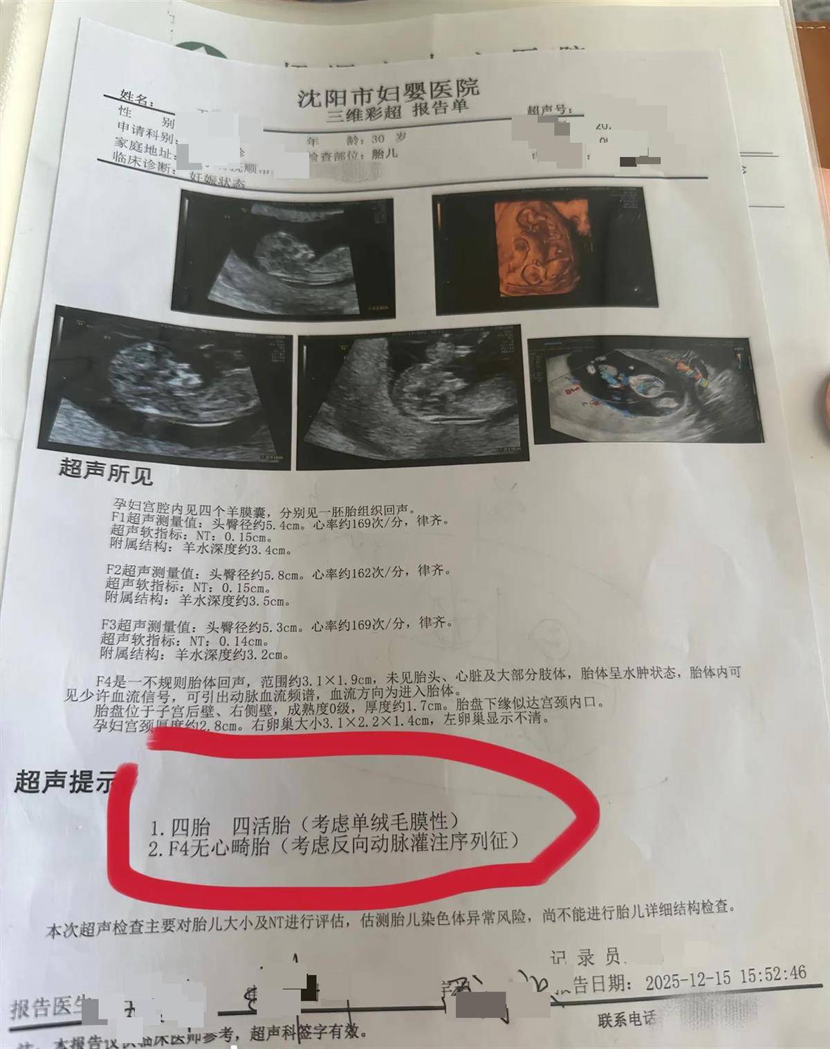 怎么开通皇冠信用开户_辽宁一孕妇两个月内从一胎变四胞胎怎么开通皇冠信用开户，每次产检发现多出一胎，医生：系同卵四胞胎，概率1300万至1500万分之一
